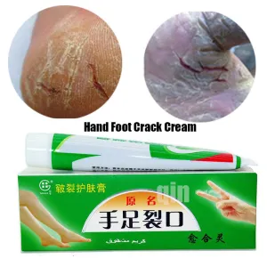 Hand Foot Crack Cream Heel Chapped Peeling Foot and hand Repair Anti Dry Crack Skin Chinese Medicinal Ointment Cream skin care